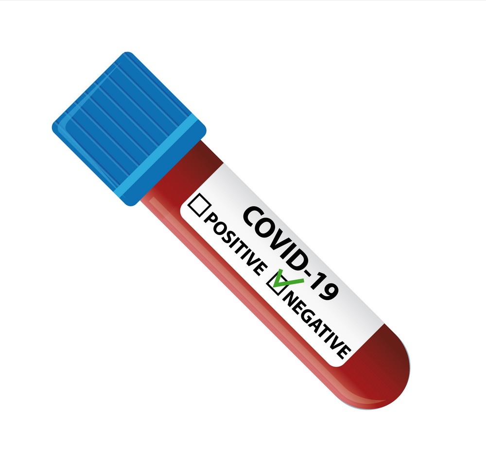Covid-19 සාදිතයින් 378 දෙනෙකු සුවය ලබයි