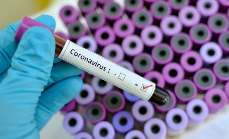 පාසලක 12 වන ශ්‍රේණියේ සිසුවෙකුට Covid-19 ආසාදනය වේ.